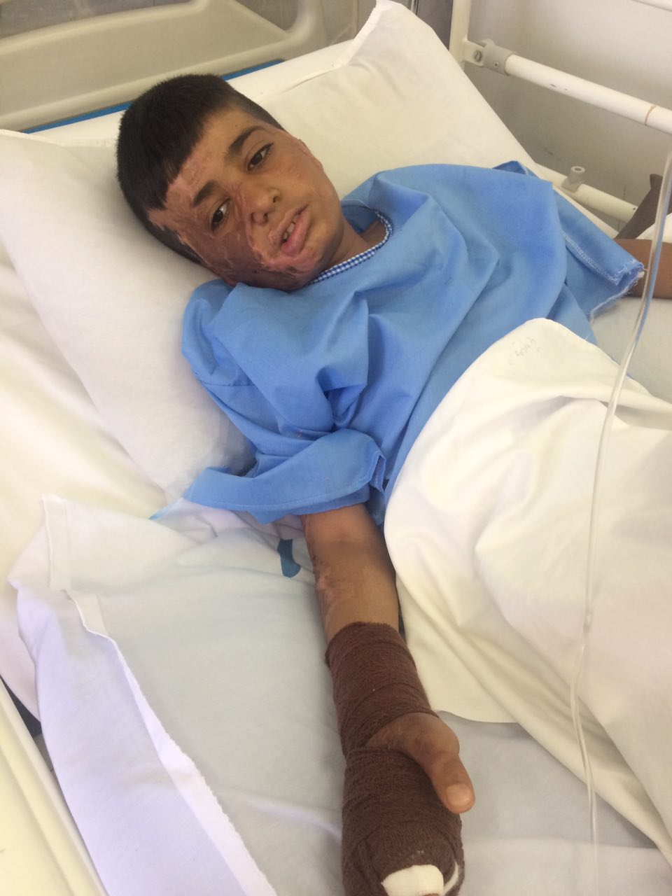 Do not let it keep silent! Mohammad had a successful surgery by help of Mehrafarin members.