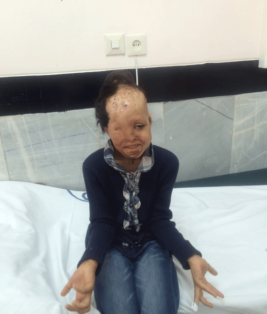 جراحی رعنا در اصفهان موفقیت آمیز بوده است