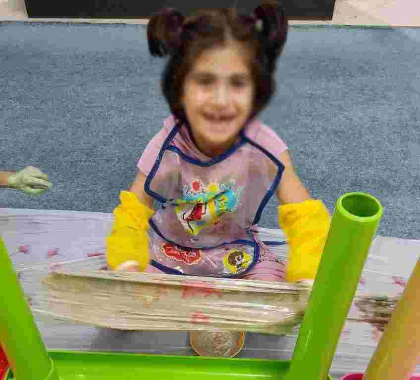 این دختر ۵ ساله توسط مادرش رها شده و در مهد مهر کرج نگهداری می‌شود/ جراحی شکاف کام نادیا نیازمند ۱۵ میلیون تومان