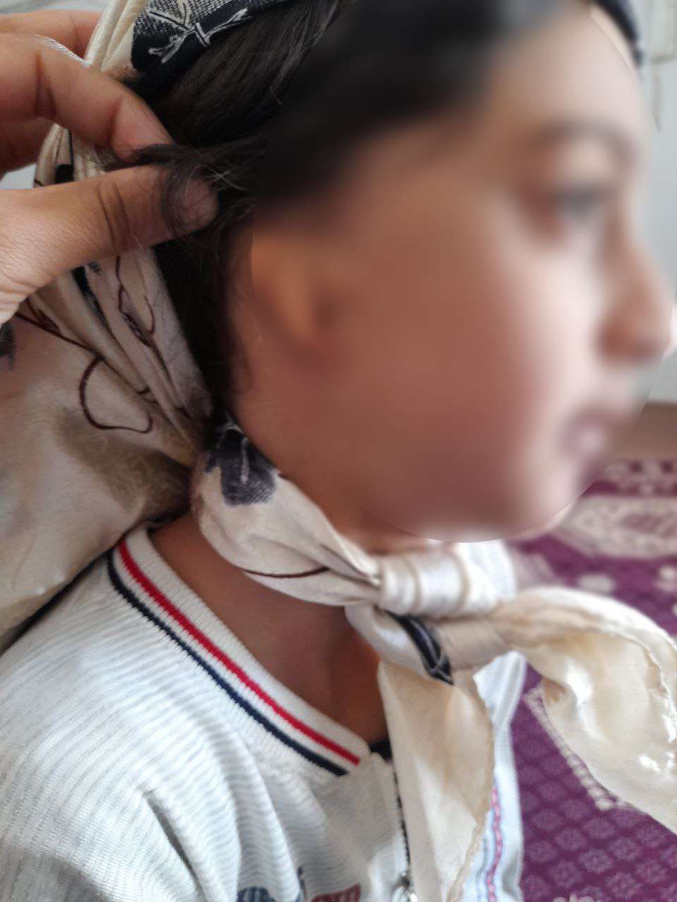 دختر ۸ ساله مازندرانی از یک اختلال مادرزادی رنج می‌برد/ جراحی گوش فاطمه نیازمند ۳۰ میلیون تومان