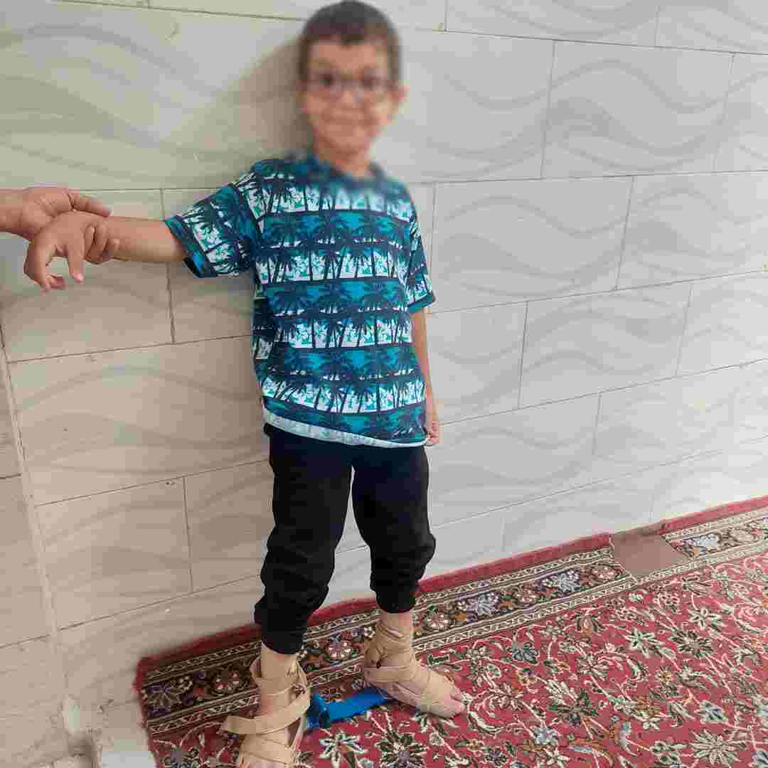 پاهای این پسر هفت ساله باید جراحی شود/ درمان محمدحسن نیازمند ۳۰ میلیون تومان