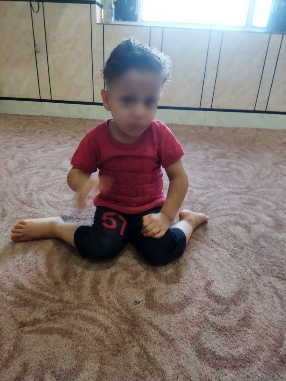 کودک ۳ ساله خوزستانی نمی‌تواند راه برود/ درمان پاهای سجاد نیازمند ۲۰ میلیون تومان 