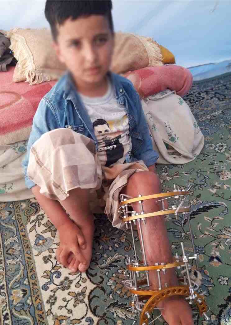 پسر ۸ ساله کرمانشاهی از یک مشکل مادرزادی رنج می‌برد/ تهیه کفش طبی برای آریا نیازمند ۱۵ میلیون تومان